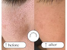 ユヌランコント 岐阜店(Une rencontre)/エンビロン