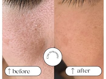 ユヌランコント 岐阜店(Une rencontre)/エンビロン