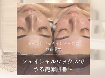 ホワイトワックス つくば店(WHITE WAX)/韓国では当たり前？