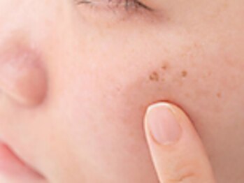 キビック(KIBIK)の写真/《シミケア＋プラズマシャワーでハリツヤ肌♪》お肌のターンオーバーを整え、年齢や季節のお肌悩みも改善！