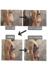 ヴィトワ(Vitowa)/ウルトランスフォーマー施術例10