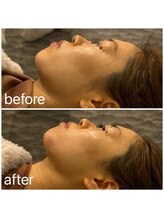 ビュウナ 銀座(BEAUNA)/カルテットモード半顔