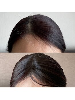 トータルビューティーサロンリア(Li'a)/髪の毛のさまざまなお悩みに◎