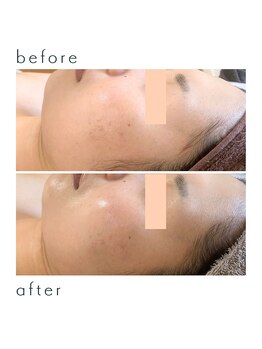 ソラ(Sora)/潤う水光肌