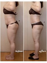 アンフィニ(infini)/全身短期集中コース8回（3ヶ月)