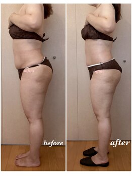 アンフィニ(infini)/全身短期集中コース8回(3ヶ月)