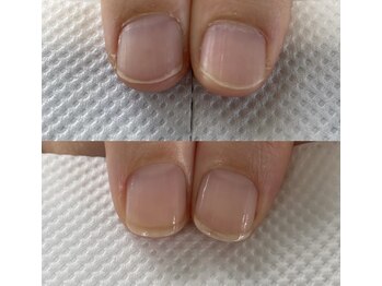 お爪を育てるネイルケア!