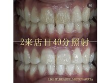 ライトビューティー 本八幡店(LIGHT BEAUTY)/【セルフホワイトニング】