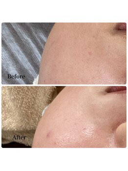 モスト(MOST)/エンビロンでビタミンAを導入