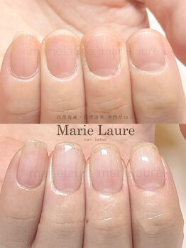 マリーロール 淀屋橋本店(Marie Laure)/自爪育成/深爪矯正/ネイルケア