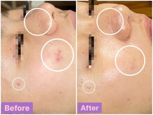 ちらちゅら/クリスティーナ