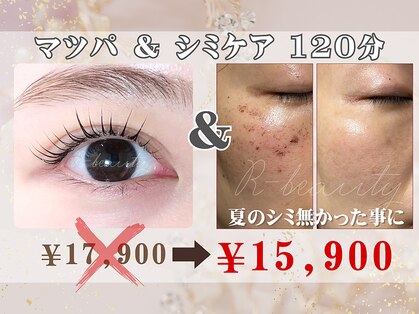 アールビューティー(R-beauty)の写真