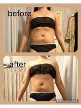 リープ(Lieb)/ボディビフォーアフター