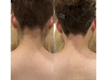 アンビジュ(un bijou)/おめでとうございます♪