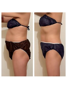 ボディーワークス 新町(BODY WORKS)/いくつになっても遅くない!!