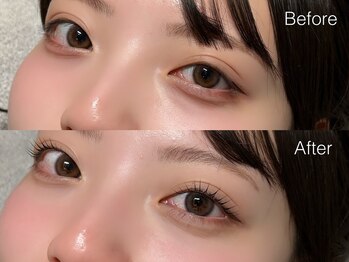 ジュベアイラッシュ 別府店(juve. eyelash)/UPforce Lift