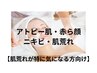 【赤み・痒み・ニキビ・肌荒れケア】小顔マッサージ付◎￥12000→￥6600
