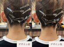 クラームビューティー(Clerm beauty)/美容師によるうなじデザイン脱毛