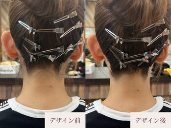 クラームビューティー(Clerm beauty)/美容師によるうなじデザイン脱毛
