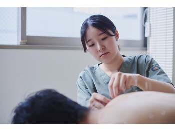 渋谷ビファイン鍼灸治療院の写真/繰り返す慢性的な首肩のお悩みや眼精疲労に◎鍼の力で血行促進し、体の内から健康をサポート！
