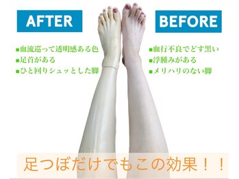 イリアス 藍住店(IRIAS)/Before/After＊足つぼ