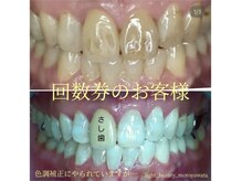 ライトビューティー 本八幡店(LIGHT BEAUTY)/【セルフホワイトニング】