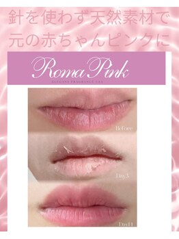 エステサロン マーヴェラス/ローマピンクでベビーピンク唇へ