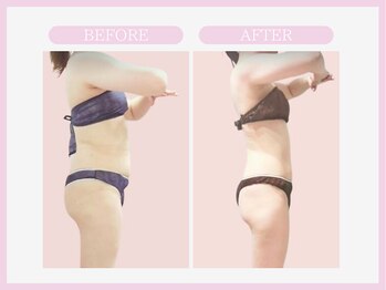 スリムライン 盛岡店(The Slim Line)/before→after