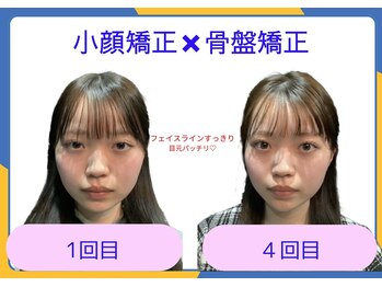 ビオラス 太田藤阿久店/ 本来のキュートな小顔に！