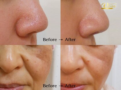 ヴィサージュ 下通店の写真