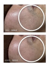 トノ(TONO)/before→after