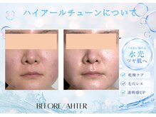 ユアーズ ビューティー(YOURS beauty)/ハイアールチューン