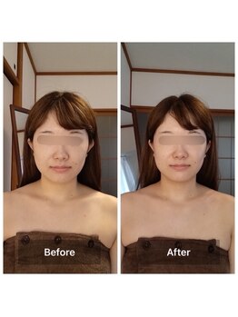 パピヨン(papillon)/ビフォーアフター