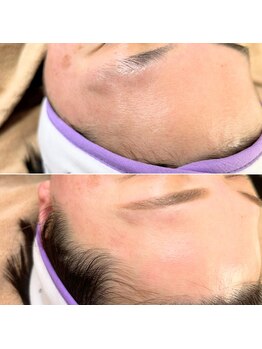 ノート(note)/フェイシャルワックス《宇都宮》