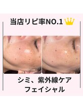 シン(Shin)/【皮脂改善フェイシャル】