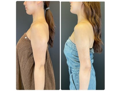 エステアンドヘアーサロン アルテ 札幌の写真