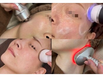 エヌフェイシャル(N.facial)の写真/若々しい印象、美白効果、シミ、しわ、たるみの改善に！30代後半～のエイジングケア！大切なイベント前にも