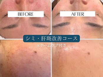 セレニア ボーテ(Selenia Beaute)/