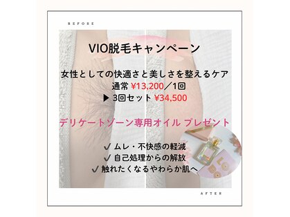 フェリエ(Ferie)の写真