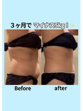 エステティック レイビス 青森店(RAYVIS)/お腹ぽスッキリを叶える！