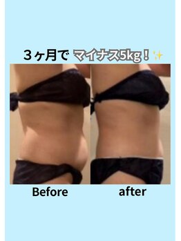 エステティック レイビス 青森店(RAYVIS)/お腹ぽスッキリを叶える！