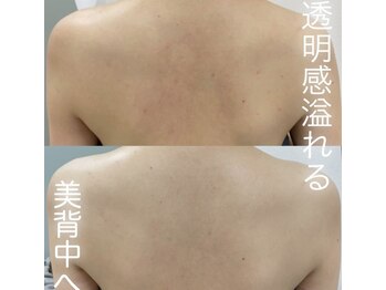 カルディエ(Cardie)/BODYハーブピーリング