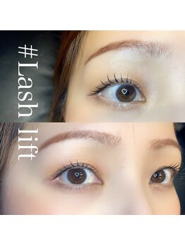 ボアップ(boappu)/キレイかわいいデザイン