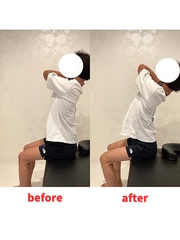 ナオル整体 福岡香椎院(NAORU整体)/30代男性施術事例【柔軟性】