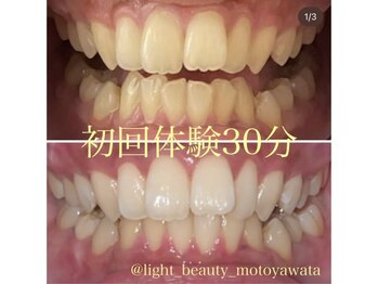 ライトビューティー 本八幡店(LIGHT BEAUTY)/【セルフホワイトニング】