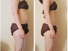 マナ(mana)/40代だるさ解消／肩こり／姿勢