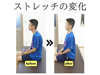 ストレッチヒーロー 岡山問屋町店/姿勢のビフォーアフター