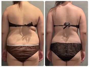 ツーアップ(2up)/背中腰回りお尻の幅