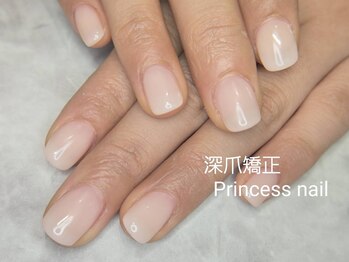 プリンセスネイル(Princess nail)/深爪矯正オフホワイトジェル