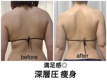 ミュー(Mieux)/オールハンド痩身でスッキリ！